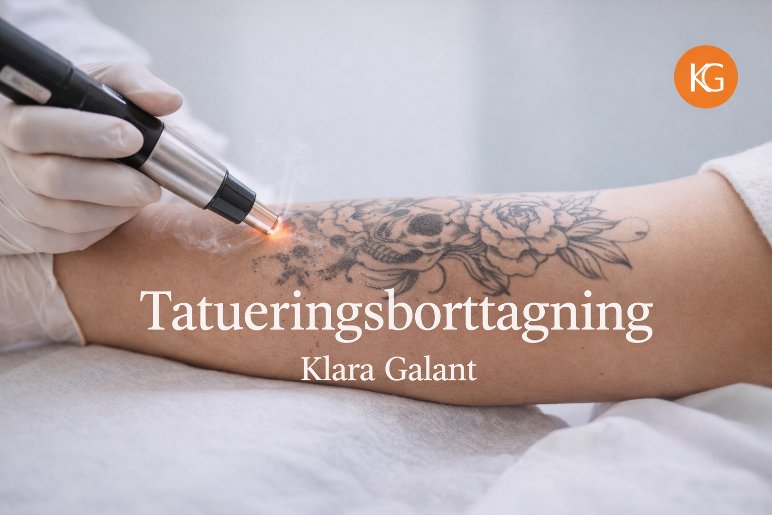 Tatueringsborttagning