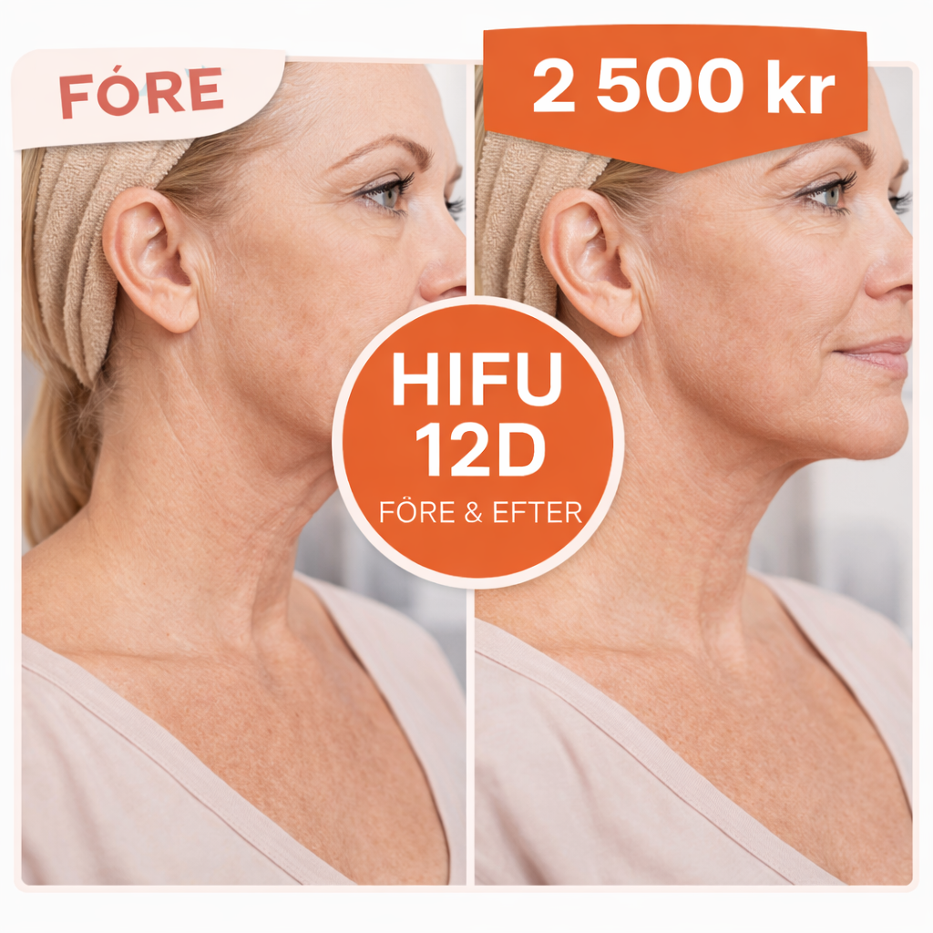 HIFU 12D Ansiktslyft – Uppstramning & Föryngring