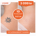 Laserbehandling för tatueringspigment 2×2 cm i Stockholm (Östermalm) – Paket 10