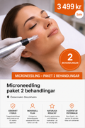 Microneedling packet 2 behandlingar