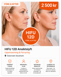 HIFU 12D Ansiktslyft i Stockholm – Uppstramning & Föryngring